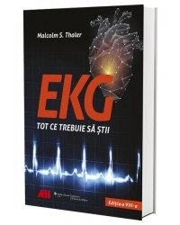 EKG - Tot ce trebuie să știi 