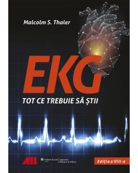 EKG - Tot ce trebuie să știi 