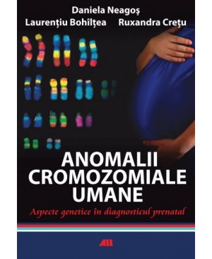 Anomalii cromozomiale umane