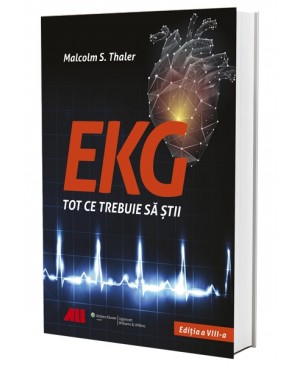 EKG - Tot ce trebuie să știi 