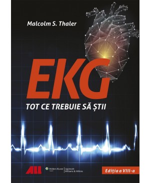 EKG - Tot ce trebuie să știi 