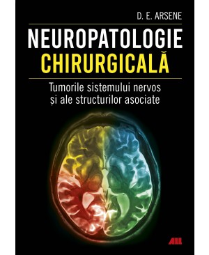 Neuropatologie chirurgicală. Tumorile sistemului nervos și ale structurilor asociate