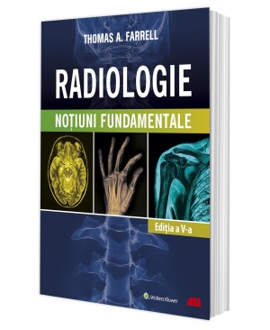RADIOLOGIE. Noţiuni fundamentale