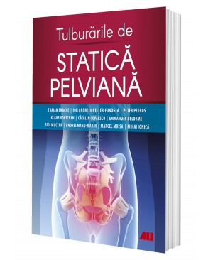 Tulburările de statică pelviană