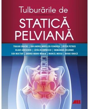 Tulburările de statică pelviană